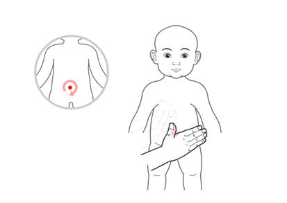 小兒推拿治療感冒嗎？